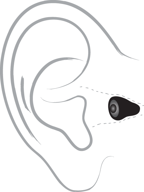 Technical drawing of an invisible in-ear hearing device positioned within an ear outline.