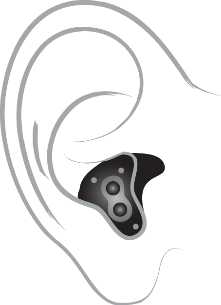 In the canal hearing aid diagram